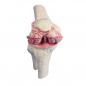 Preview: ERLER-ZIMMER | Knie-Implantat-Modell (1125)