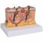 Preview: ERLER-ZIMMER | pathologisches Hautmodell (J755)