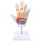 Preview: HeineScientific | rheumatoide Arthritis (H139057)