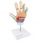 Preview: HeineScientific | rheumatoide Arthritis (H139057)