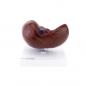 Preview: HeineScientific | Lebermodell mit Gallensteinen (H139056)