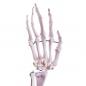 Preview: HeineScientific | Skelettmodell Arm (H139151)
