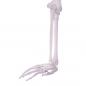 Preview: HeineScientific | Skelettmodell Arm (H139151)