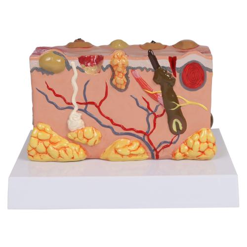 ERLER-ZIMMER | pathologisches Hautmodell (J755)