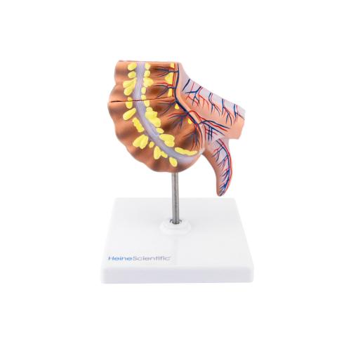 Appendix und Caecum