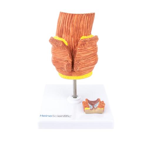 HeineScientific | Hämorrhoidenmodell (H139050)