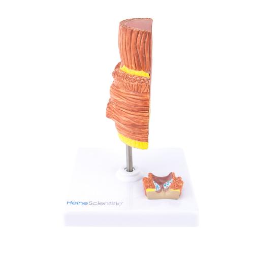 HeineScientific | Hämorrhoidenmodell (H139050)