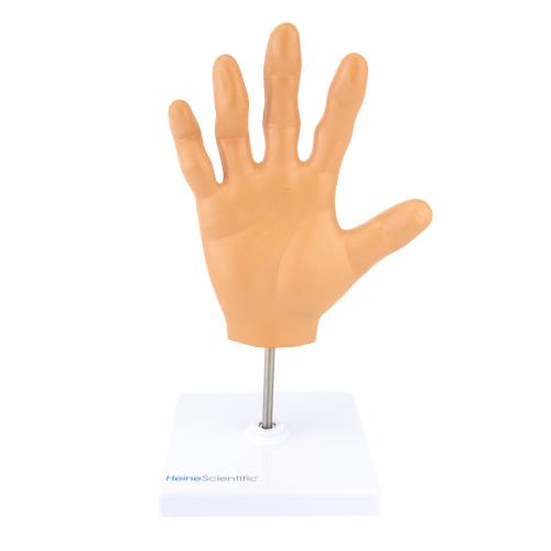HeineScientific | rheumatoide Arthritis (H139057)