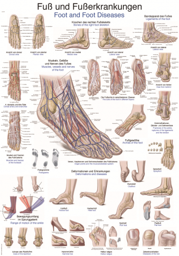Lehrtafel Fuß Fußerkrankungen (70 x 100)