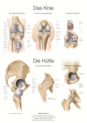 Lehrtafel Knie Hüfte (70 x 100)