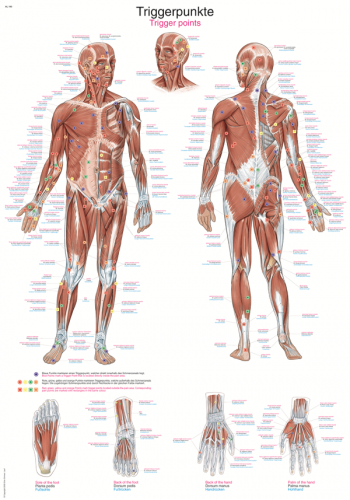 Lehrtafel Triggerpunkte (50 x 70)