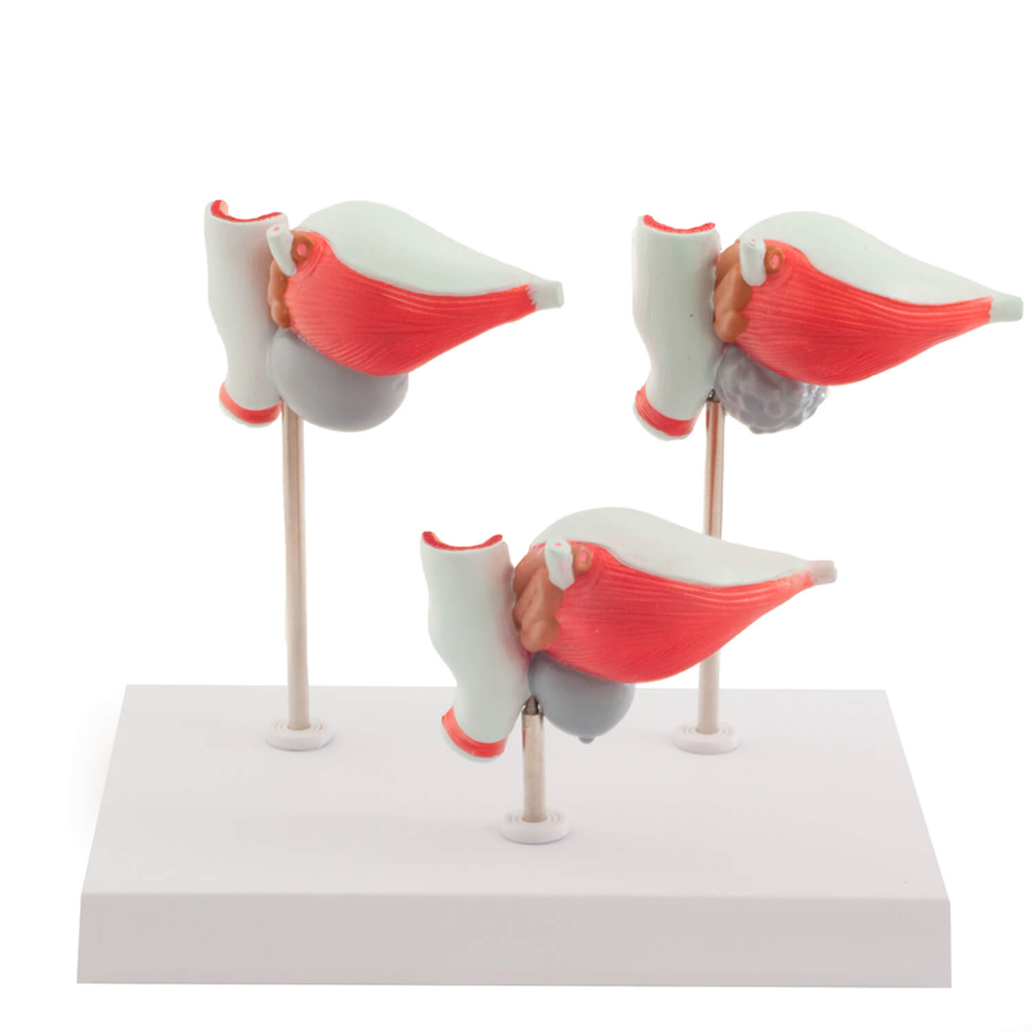 HeineScientific Prostata (H130033)