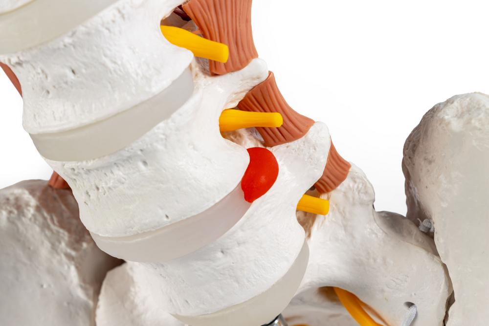 Erler-Zimmer | männliches Becken LWS Lendnemuskel (4044)