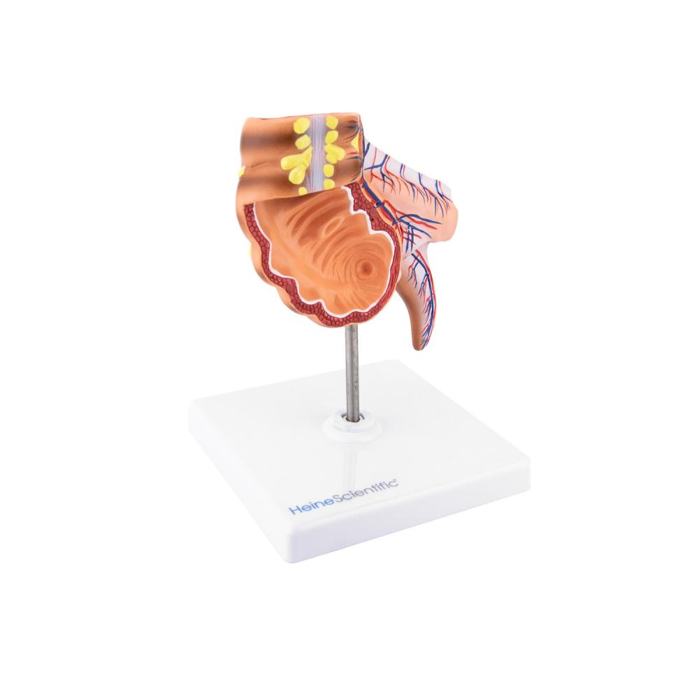 HeineScientific | Appendix Caecum (H139015)