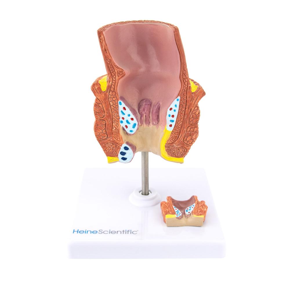 HeineScientific | Hämorrhoidenmodell (H139050)