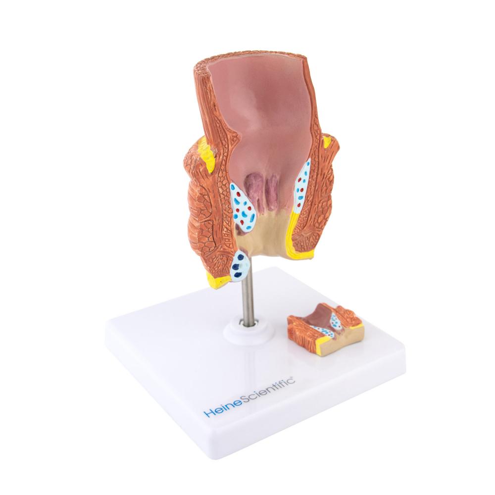 HeineScientific | Hämorrhoidenmodell (H139050)