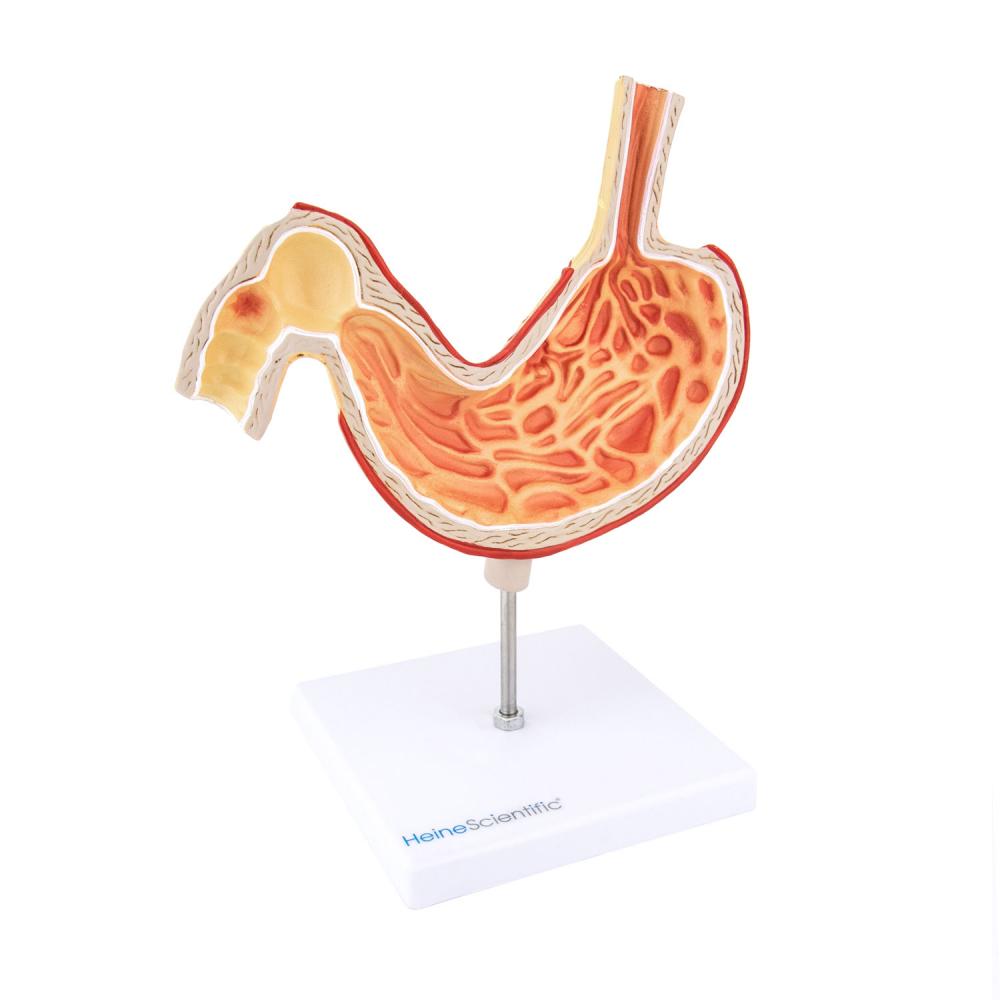 HeineScientific | Magenmodell mit Ulzera (H139052)