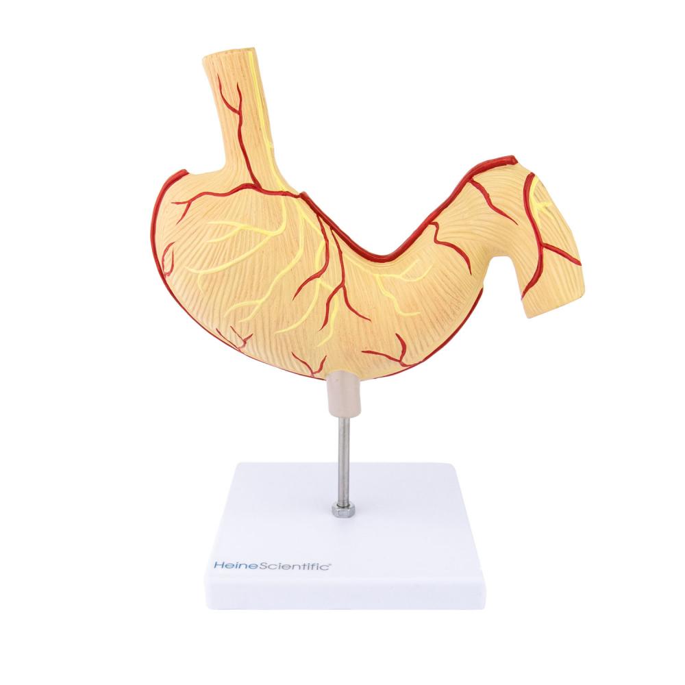 HeineScientific | Magenmodell mit Ulzera (H139052)