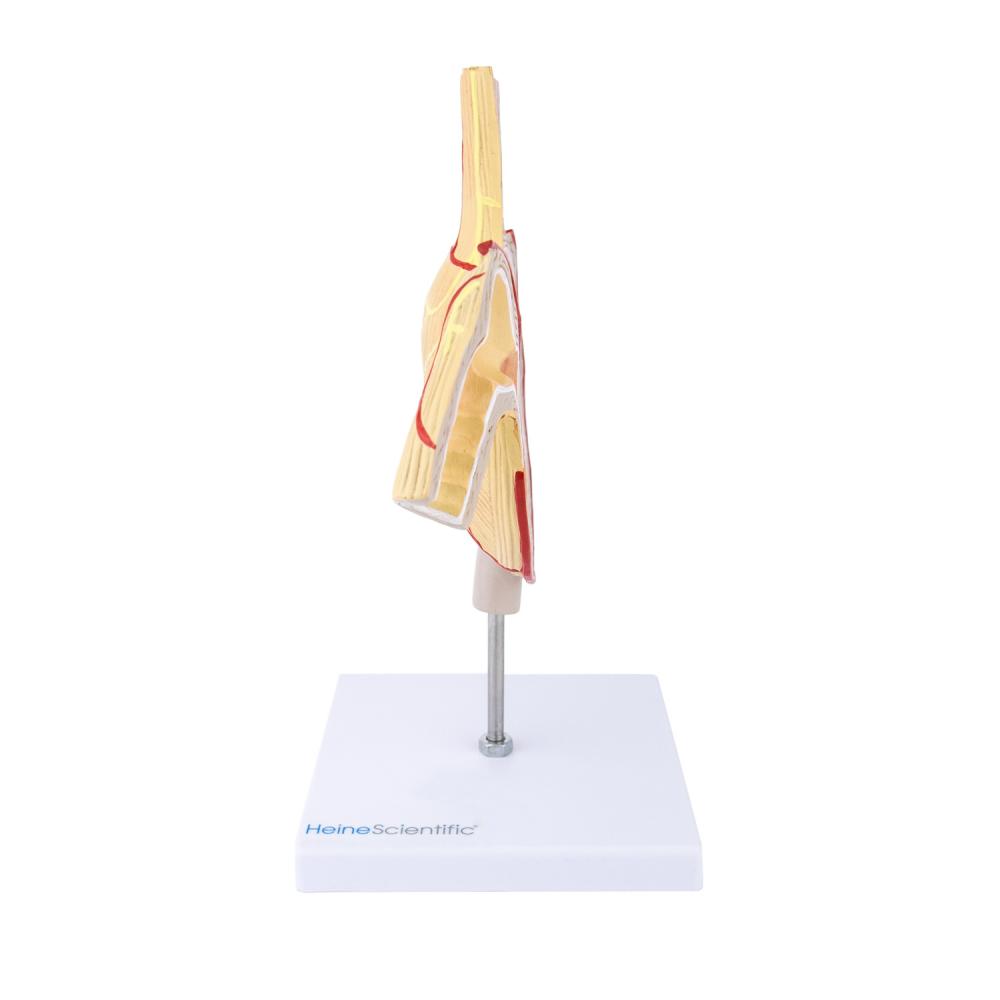 HeineScientific | Magenmodell mit Ulzera (H139052)