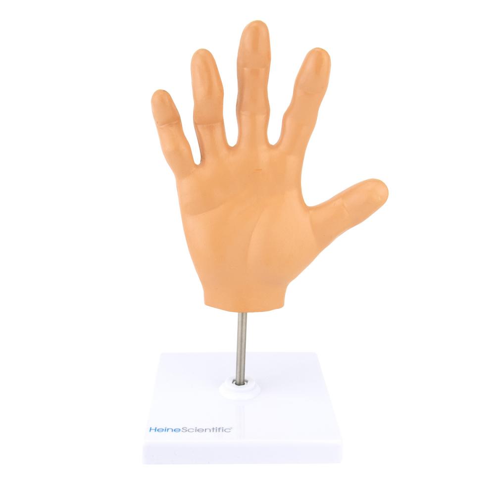 HeineScientific | rheumatoide Arthritis (H139057)