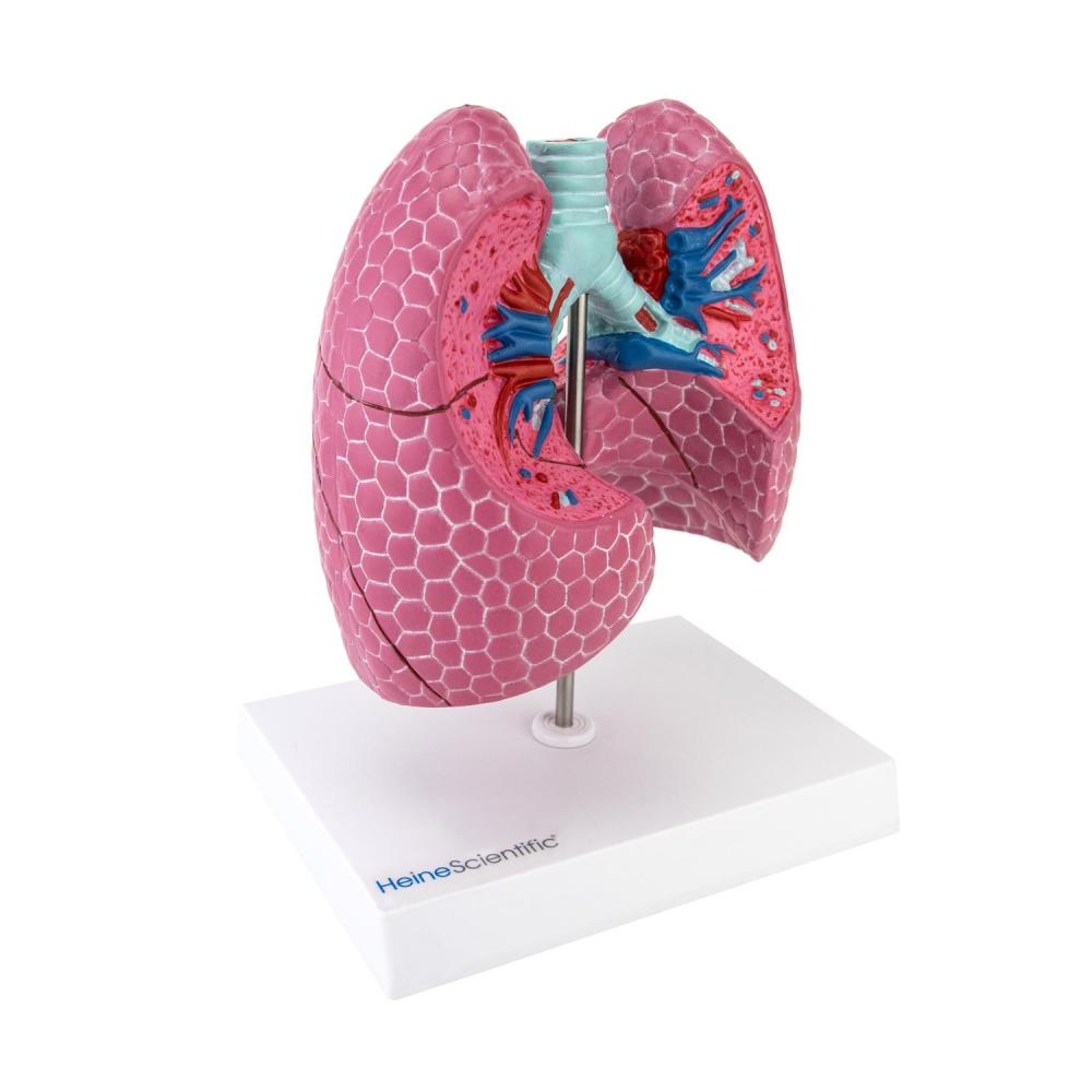 HeineScientific | Lungenerkrankungen (H139066)