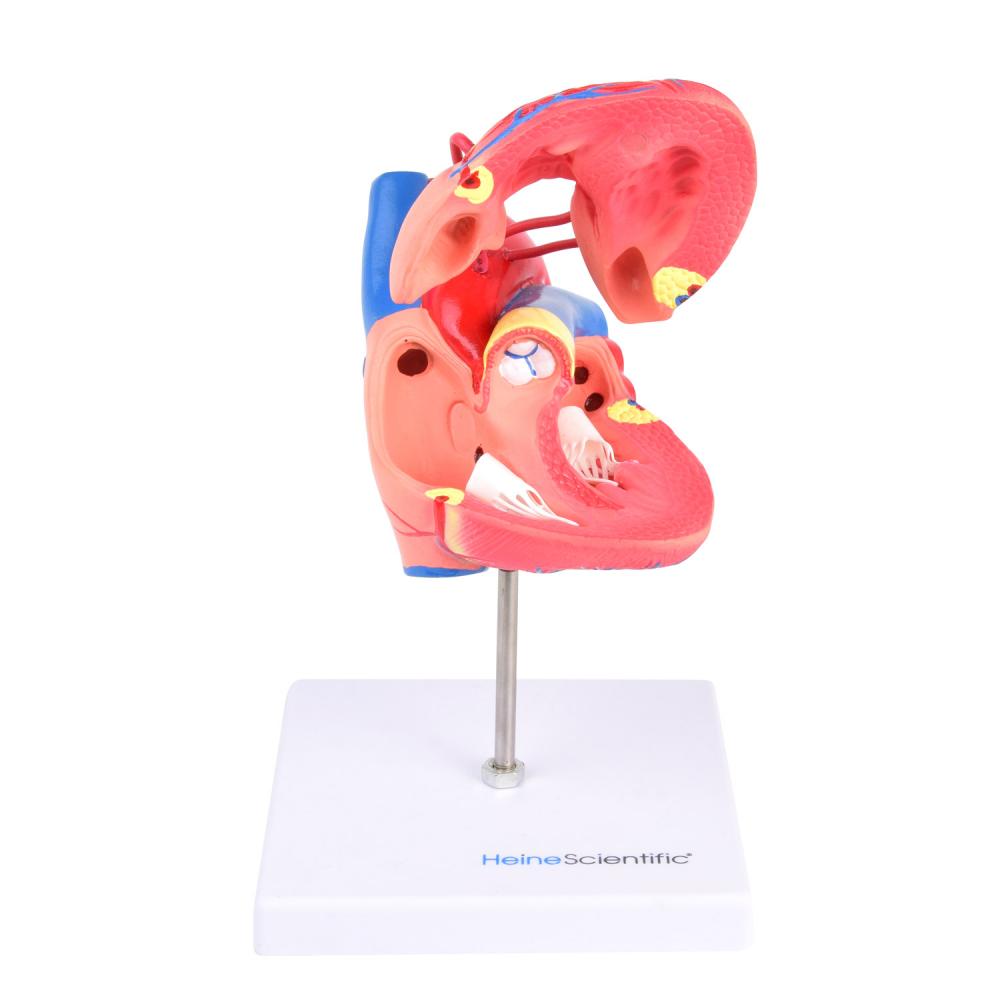 HeineScientific | Bypassmodell (H139081)