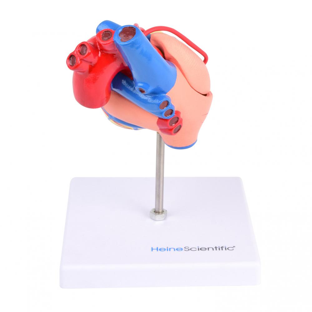 HeineScientific | Bypassmodell (H139081)