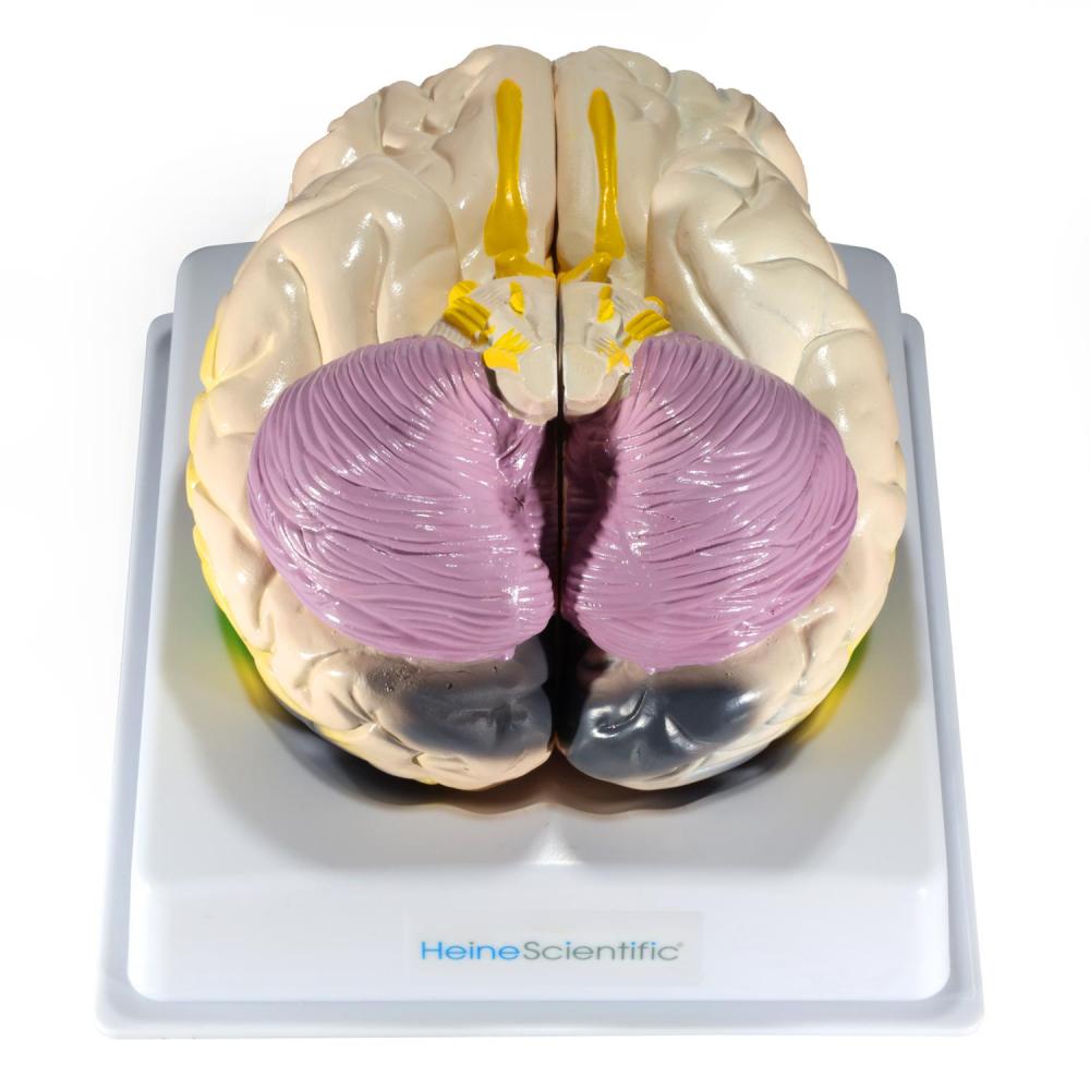 HeineScientific | Gehirnmodell mit Funktionsbereichen (H139086)