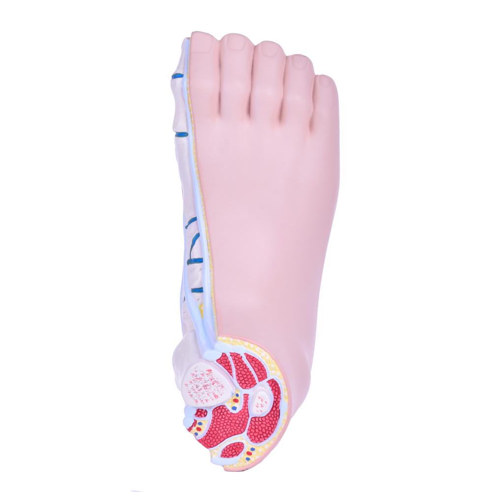 HeineScientific | Fussfehlstellungsmodell (H139153)