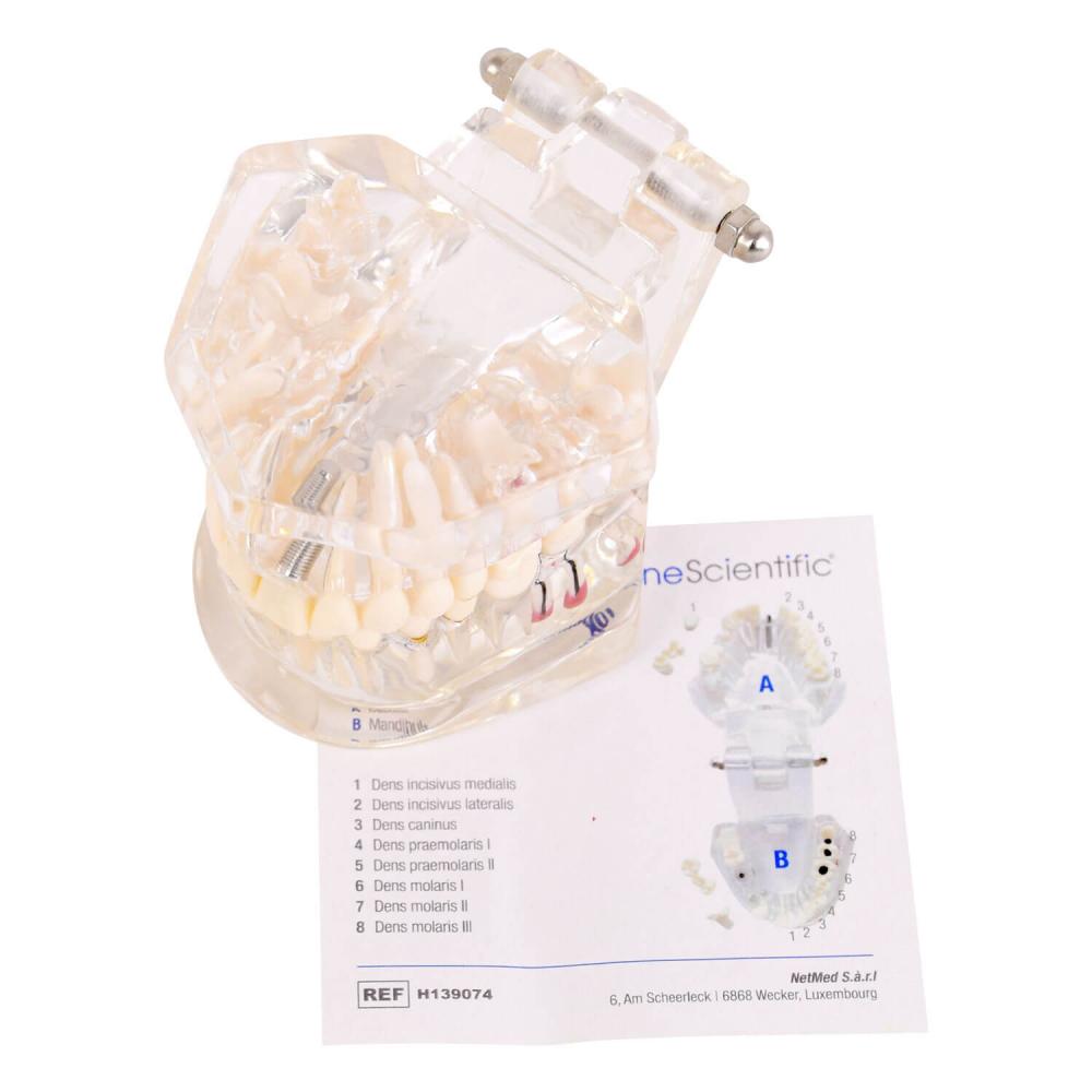 HeineScientific | transparentes Kiefermodell Erwachsener (H139074)