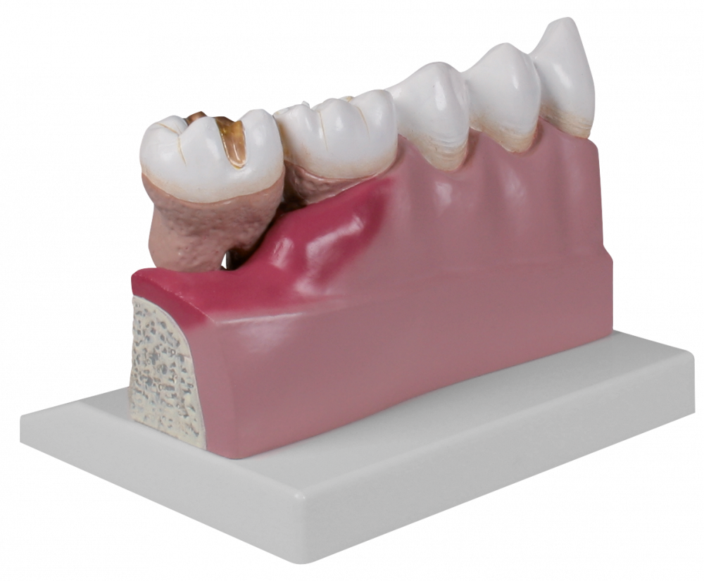 ERLER-ZIMMER | Dentalmodell (D250)