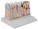 Dentalmodell